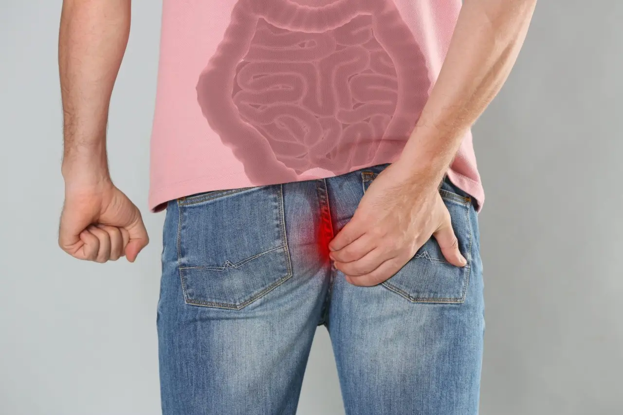 Emorroidi infiammate, cosa mangiare per sgonfiarle? La dieta giusta per un sollievo rapido
