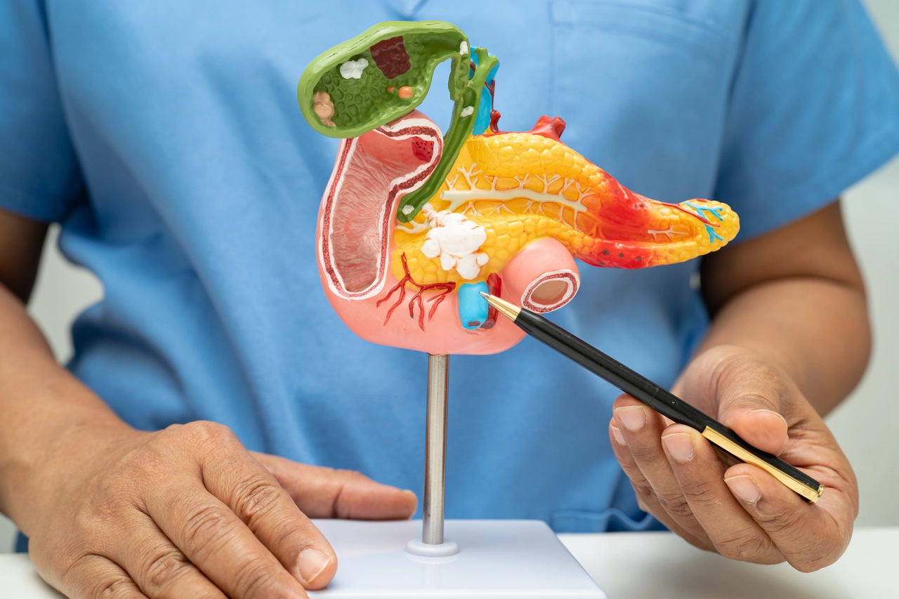 Tumore al rene: ecco gli alimenti da evitare assolutamente per non peggiorare la situazione