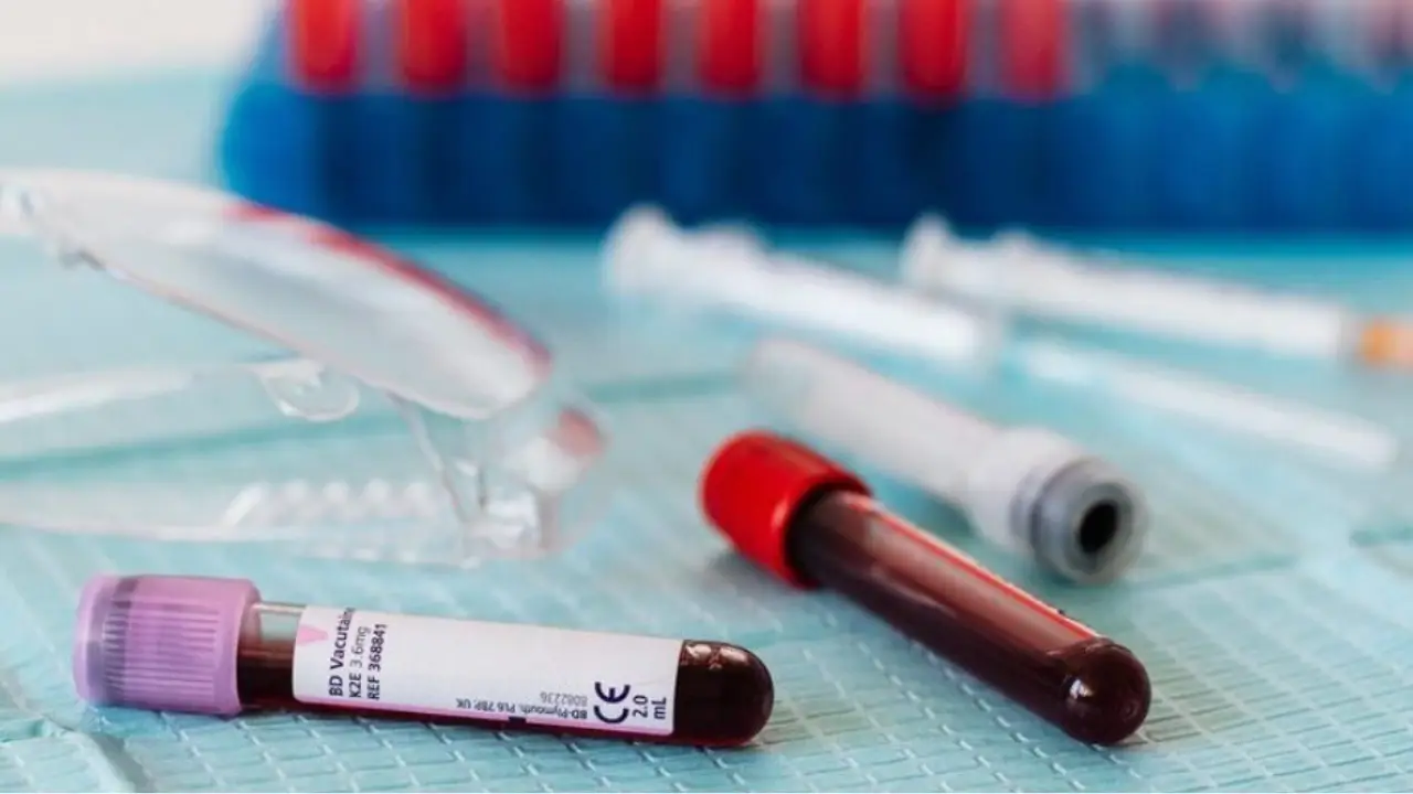 Attenzione prima delle analisi: ecco i cibi comuni che falsano i risultati del sangue