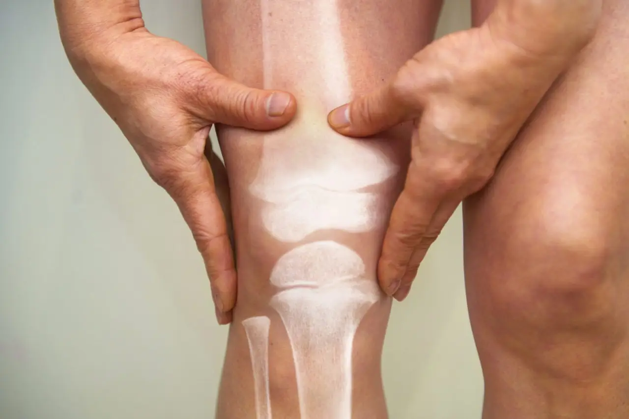 Hai l’osteoporosi? Non sederti mai in questo modo o rischi fratture senza accorgertene